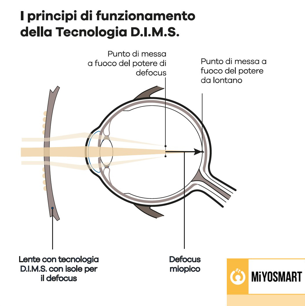 miyosmart-occhiali